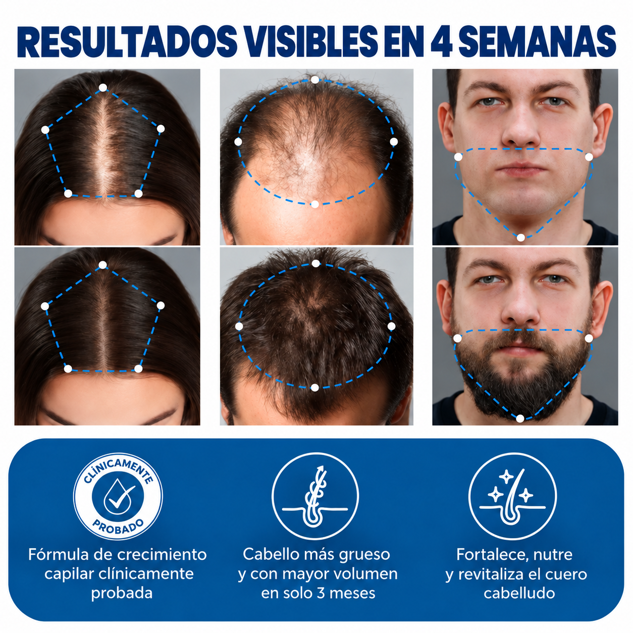Sérum Roll-On OVELTON para el Crecimiento Capilar Avanzado