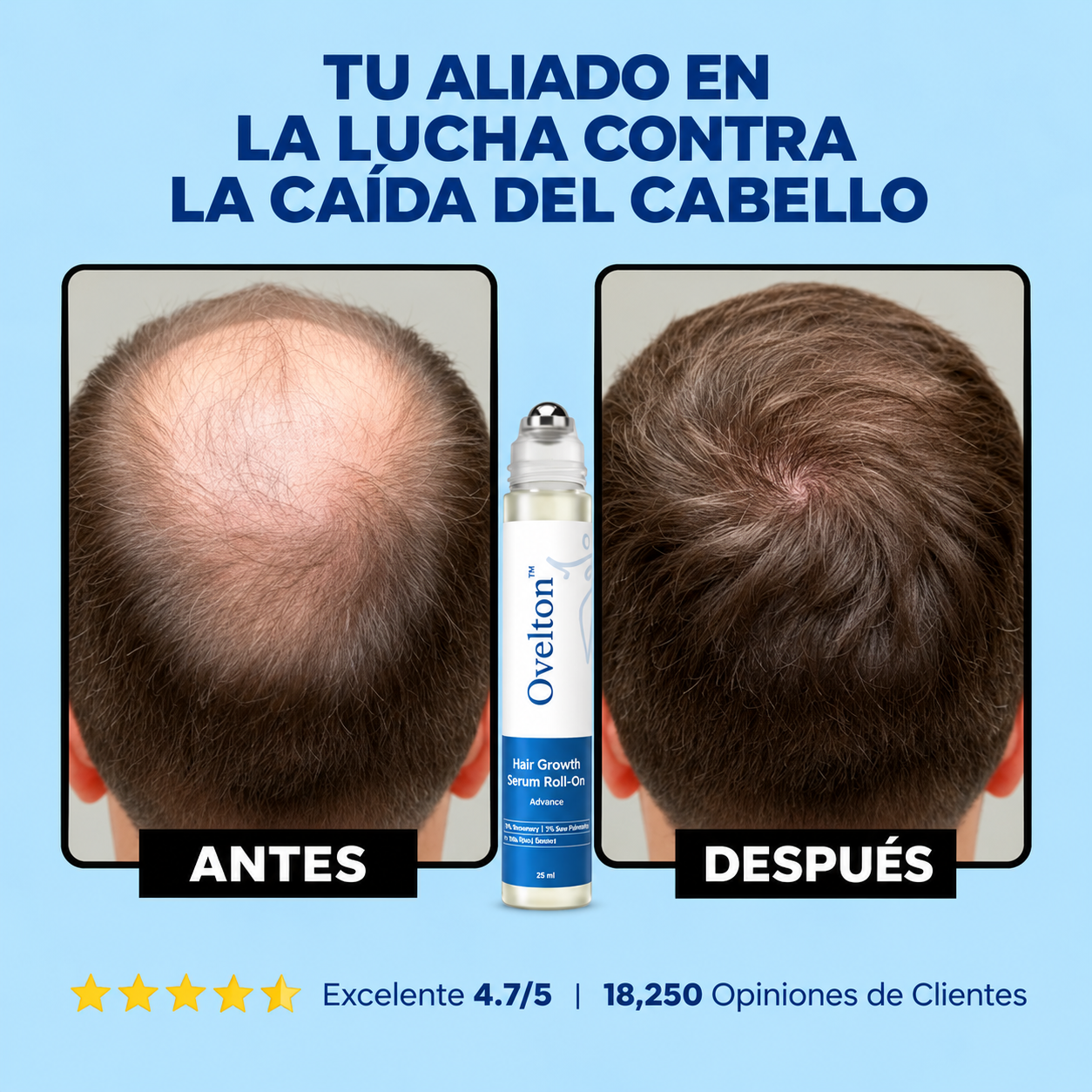 Sérum Roll-On OVELTON para el Crecimiento Capilar Avanzado